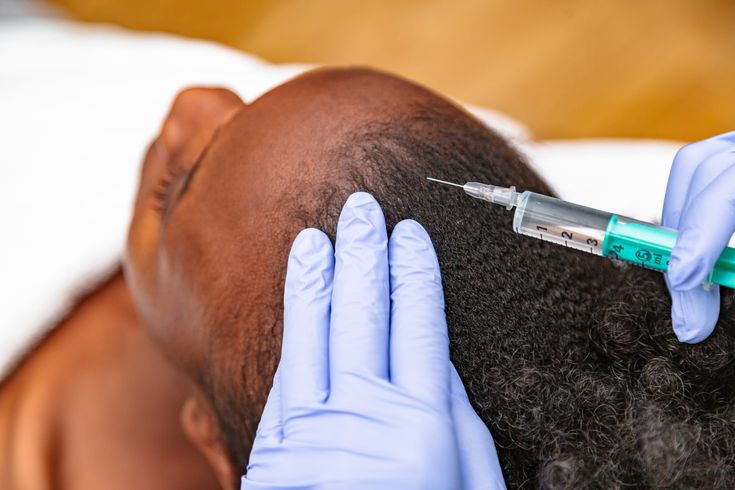 PRP Buttock Enhancement PRICE: $850